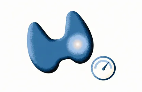 A butterfly-shaped thyroid in blue with a softly glowing spot in one lobe, and beside it a small gauge with its needle pointing high.